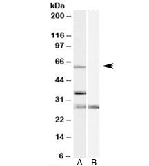 Western blot testing of HeLa cell lysate with PRPF31 antibody at 1ug/ml with [B] and without [A] blo