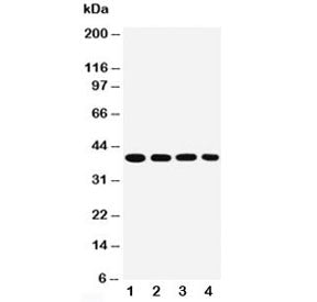 Western blot testing of human 1) SMMC-7721, 2) MCF-7, 3) Raji and 4) SW620 cell lysate with MTCO1 an