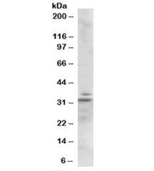 Western blot testing of mouse heart lysate with Lime antibody at 1ug/ml. Predicted molecular weight: