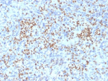 IHC staining of FFPE human spleen with PU.1 antibody (clone PU1/2146). HIER: boil tissue sections in