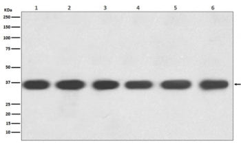 Western blot testing of 1) human HeLa, 2) human Jurkat, 3) mouse kidney, 4) mouse spleen, 5) mouse R