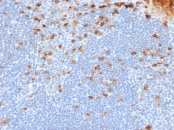 IHC testing of FFPE human tonsil tissue with recombinant Kappa Light Chain antibody (clone rL1C1). R