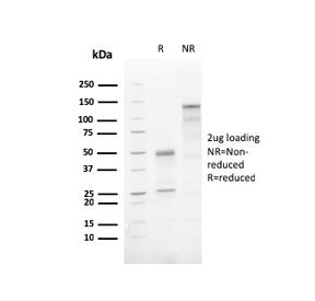 ATG5 Antibody