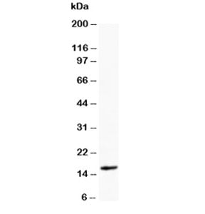 Western blot testing of Myoglobin antibody and rat skeletal muscle tissue lysate. Predicted molecula