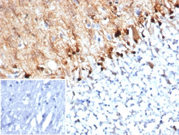 IHC staining of FFPE human brain tissue with S100B antibody (clone S100B/4152) at 2ug/ml. Inset: PBS