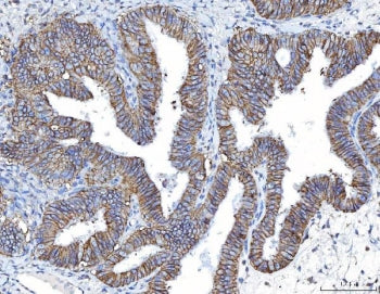Poliovirus Receptor Antibody / PVR