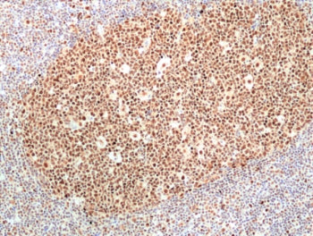 Ribonuclease H2 subunit B Antibody / RNASEH2B
