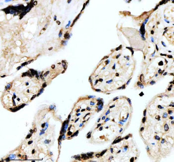 IHC staining of FFPE human placental tissue with FOXF1 antibody, HRP-secondary and DAB substrate. HI