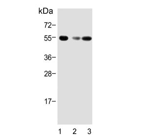Western blot testing of 1) human brain, 2) mouse brain and 3) rat brain tissue lysate with Activin r