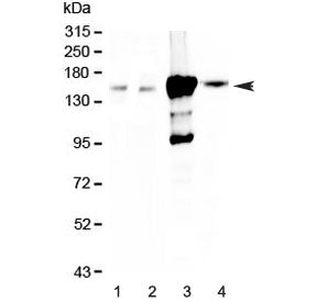 Western blot testing of 1) rat kidney, 2) mouse kidney, 3) human 293T and 4) human HK-2 lysate with 
