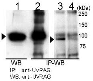 Immunoprecipitation and western blot analysis using UVRAG antibody with 293T cells. UVRAG is immunop