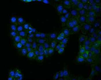 BCR Antibody / Breakpoint cluster region protein