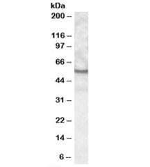 Western blot testing of human kidney lysate with UNC5CL antibody at 0.3ug/ml. Predicted molecular we