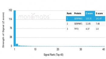 Analysis of a HuProt(TM) microarray containing more than 19,000 full-length human proteins using AAT