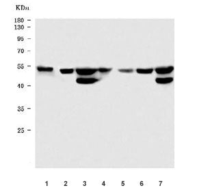 STK24 Antibody / Serine/threonine-protein kinase 24 / MST-3