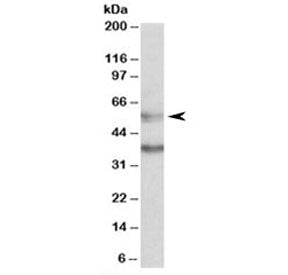 Western blot testing of K562 lysate with CBARA1 antibody at 0.5ug/ml. Predicted molecular weight: ~5
