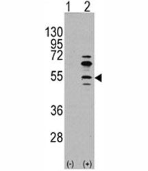Western blot analysis of MEF2C antibody and 293 cell lysate (2 ug/lane) either nontransfected (Lane 