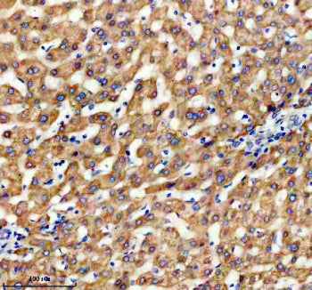 Immunohistochemical staining of TIMM9 using anti-TIMM9 antibody. TIMM9 was detected in a paraffin-em