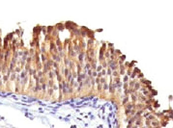 KRT10 Antibody / Cytokeratin 10