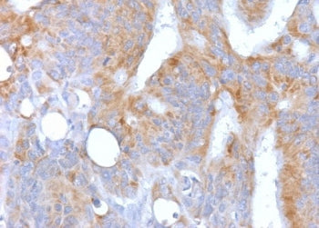 IHC testing of FFPE human colon with recombinant CD86 antibody (CDLA86-2R). Required HIER: boil tiss