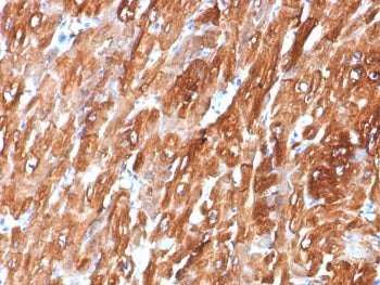 IHC staining of FFPE human heart tissue with Crystallin Alpha B antibody (clone CRYAB/7918). HIER: b