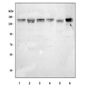 Western blot testing of 1) human 293T, 2) human MCF7, 3) human RT4, 4) human SH-SY5Y, 5) rat brain a