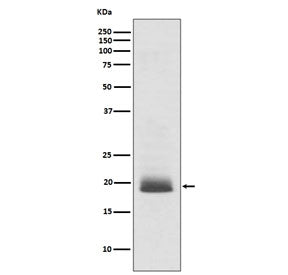 Western blot testing of human SH-SY5Y cell lysate with NRAS antibody. Predicted molecular weight ~21