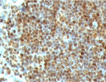 Formalin-fixed, paraffin-embedded human tonsil stained with PCNA antibody (clone PM441-1). FFPE test