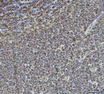 Histone deacetylase 1 Antibody / HDAC1