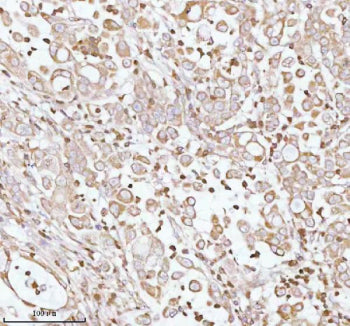 Immunohistochemical staining of PLBD2 using anti-PLBD2 antibody. PLBD2 was detected in a paraffin-em
