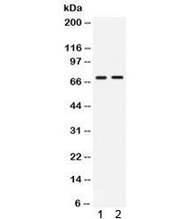 Western blot testing of human 1) HepG2 and 2) HeLa lysate with cIAP2 antibody. Predicted/observed mo