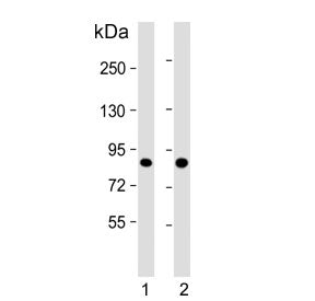 Western blot testing of human 1) A431 and 2) HeLa cell lysate with Tousled-like kinase 1 antibody. P