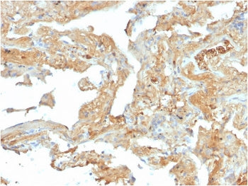 IHC staining of FFPE human lung with Fibronectin antibody (clone FN1/2950). HIER: boil tissue sectio