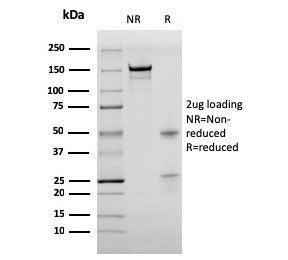 SDS-PAGE analysis of purified, BSA-free recombinant Bromodeoxyuridine antibody (clone rBRD469) as co