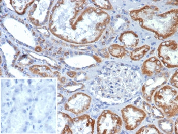 IHC staining of FFPE human kidney tissue with Fibroblast Growth Factor 23 antibody at 2ug/ml. Inset: