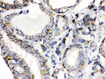 CGRP Antibody / CALCA