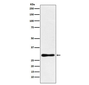 Western blot testing of human MCF7 cell lysate with DDAH2 antibody. Predicted molecular weight ~29 k