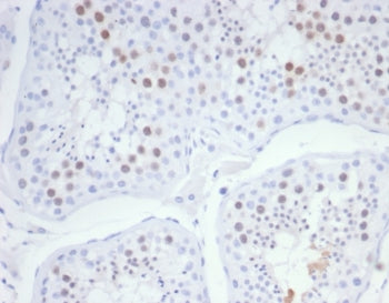 KIF2C Antibody / MCAK