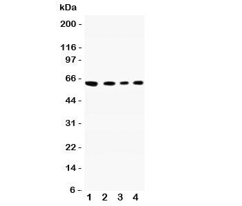 Western blot testing of CADM1 antibody and Lane 1: A549; 2: Jurkat; 3: Raji; 4: HeLa lysate. Predict