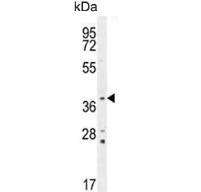 Twinfilin 2 Antibody / TWF2 / PTK9L