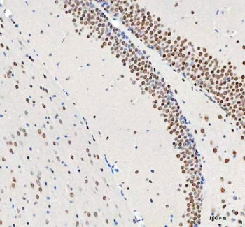 DDX1 Antibody
