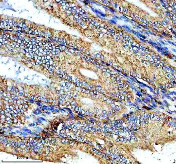 Immunohistochemical staining of NTN4 using anti-NTN4 antibody. NTN4 was detected in a paraffin-embed