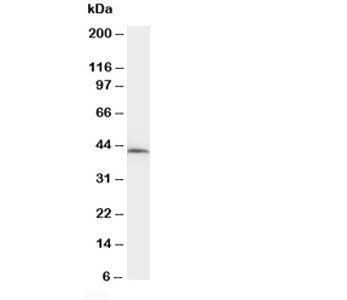 NPHS2 Antibody (Podocin)