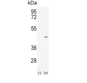 Western blot testing of 1) non-transfected and 2) transfected 293 cell lysate with Alcohol dehydroge