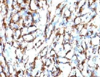 Alpha Actin Antibody / ACTA2 (smooth muscle)