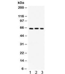 Western blot testing of 1) mouse pancreas, 2) human Jurkat and 3) human HepG2 lysate with SPP1 antib