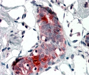 IHC testing of FFPE human breast with Mammaglobin A antibody at 4ug/ml. HIER: steamed with pH6 citra