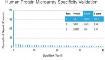 Analysis of HuProt(TM) microarray containing more than 19,000 full-length human proteins using Inter