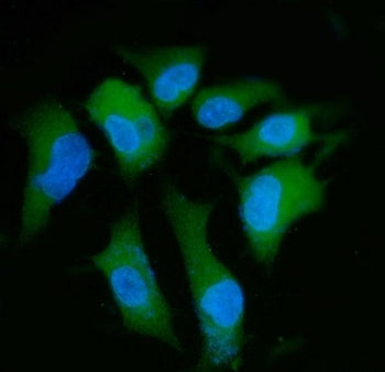 Immunofluorescent staining of FFPE human A549 cells with PPP2R1A antibody (green) and DAPI nuclear s