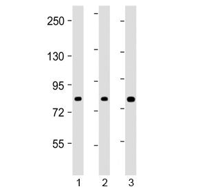 ADD1 Antibody / Alpha Adducin (Center Region)